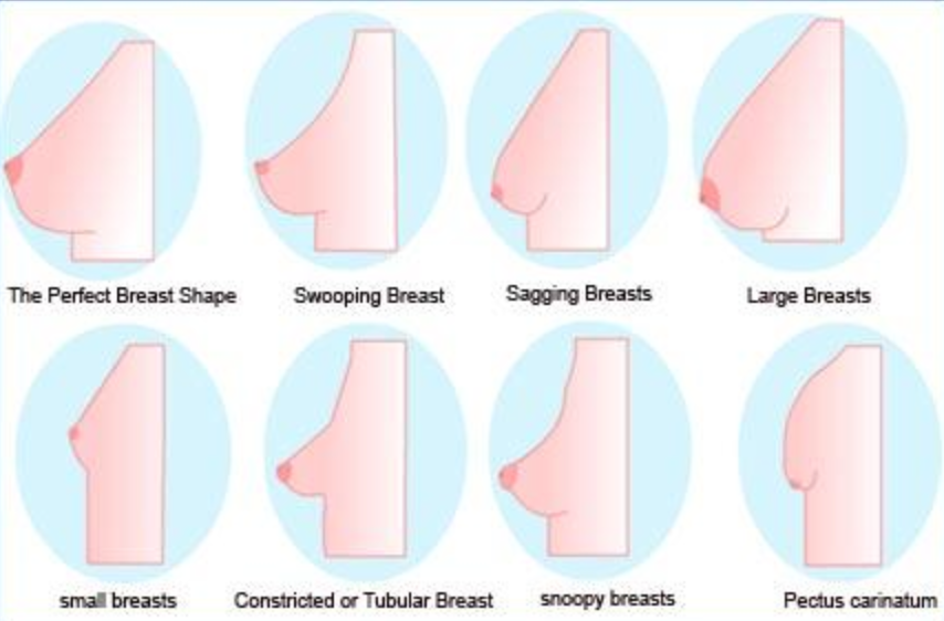 Different kinds of breasts