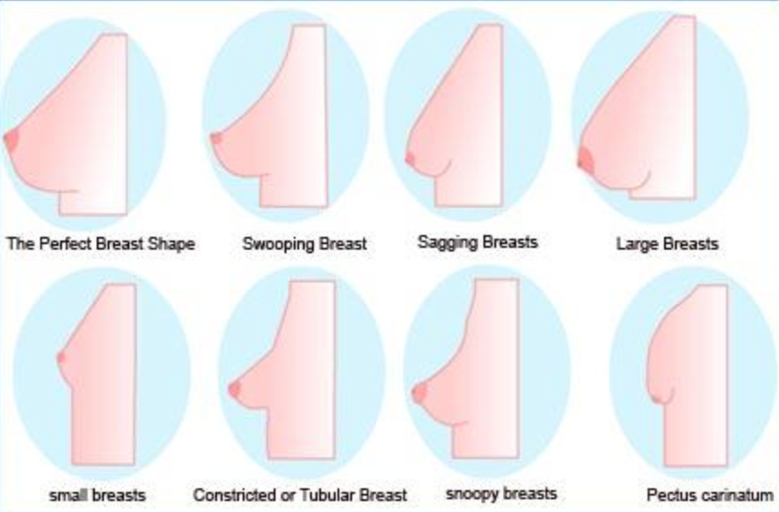 Different kinds of breasts.